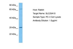 SLC25A10 Rabbit anti-Human, Polyclonal, Novus Biologicals 0.1 mL | Buy Online | Novus Biologicals | Fisher Scientific